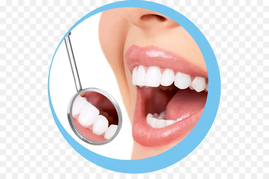 стоматология，реставрация зубов PNG