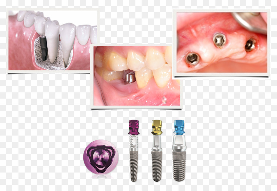 челюсти，стоматология PNG