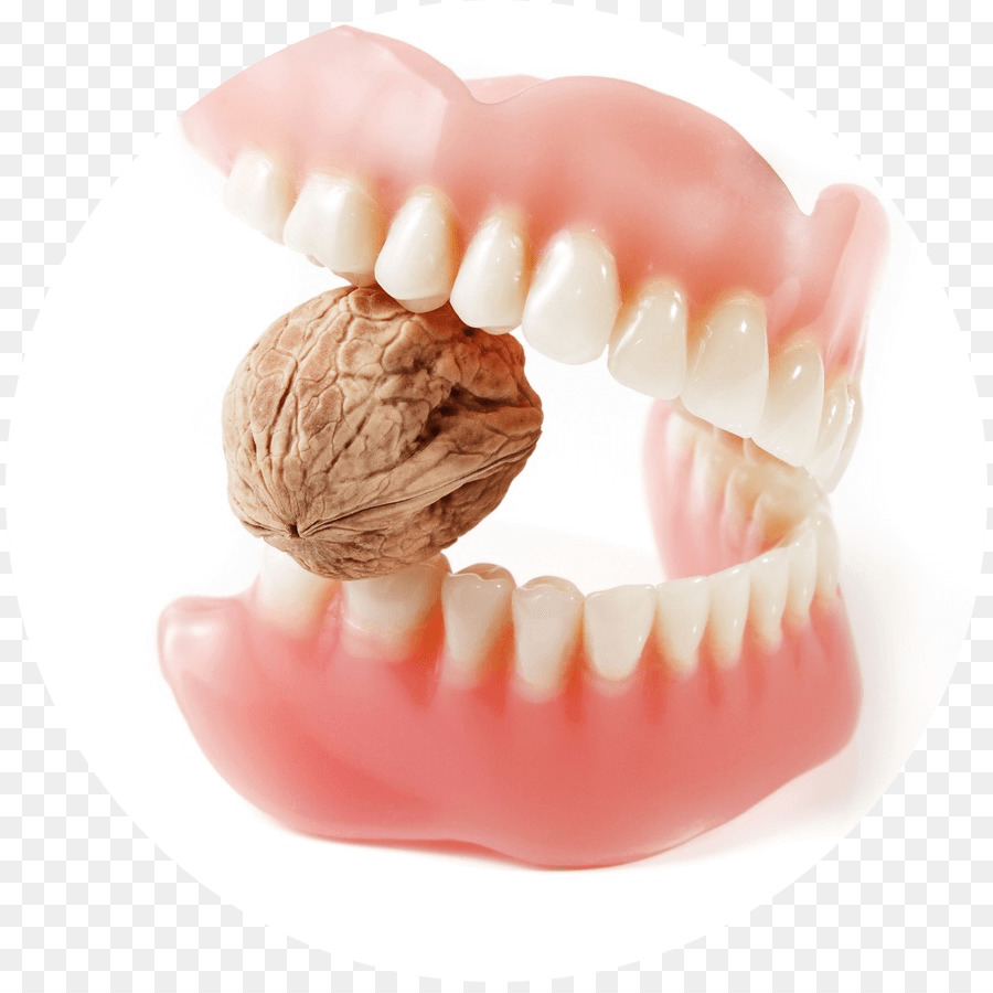 kisspng-prosthesis-tooth-bridge-royalty-free-dentures-dental-restoration-5ae142a9755519.0837927815247121054806.jpg