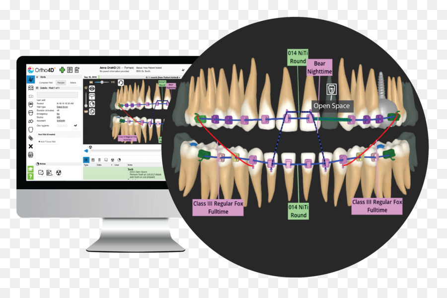 Стоматологическое программное обеспечение，Зубы PNG