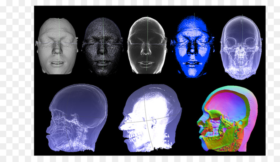 компьютерная томография，череп PNG