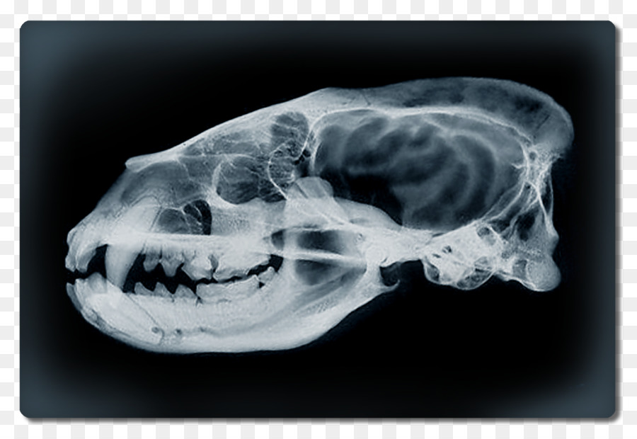 компьютерная томография，Interparietal кость PNG