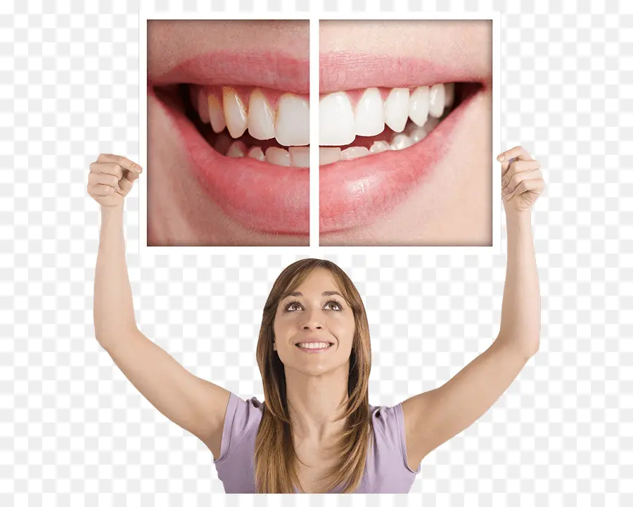 Отбеливание зубов，Стоматолог PNG